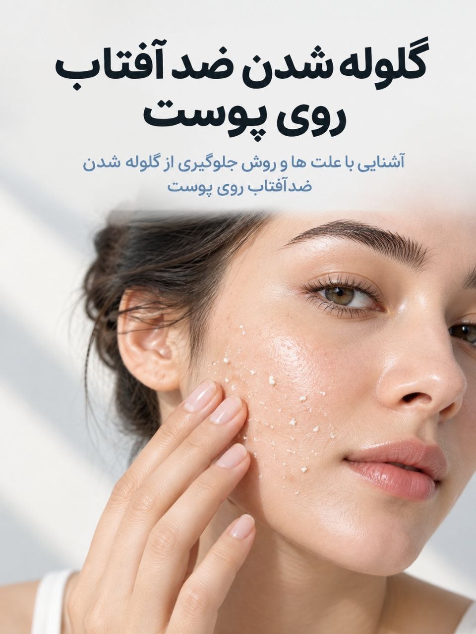 گلوله شدن ضدآفتاب